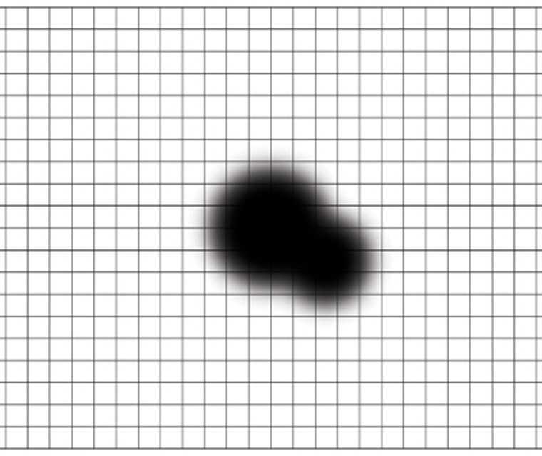 Ratgeber Makula: Das Bild zeigt ein Amlser-Gitter mit schwarzen Flecken Die Grafik zeigt ein Gitter mit senkrechten und waagerechten Linien in immer gleichen Abständen zueinander, die viele kleine Quadrate identischer Größe bilden. Genau in der Mitte des Gitters sind zwei unterschiedlich große schwarze Flecken zu sehen. Auch das ist ein weiteres mögliches Symptom des DMÖ.