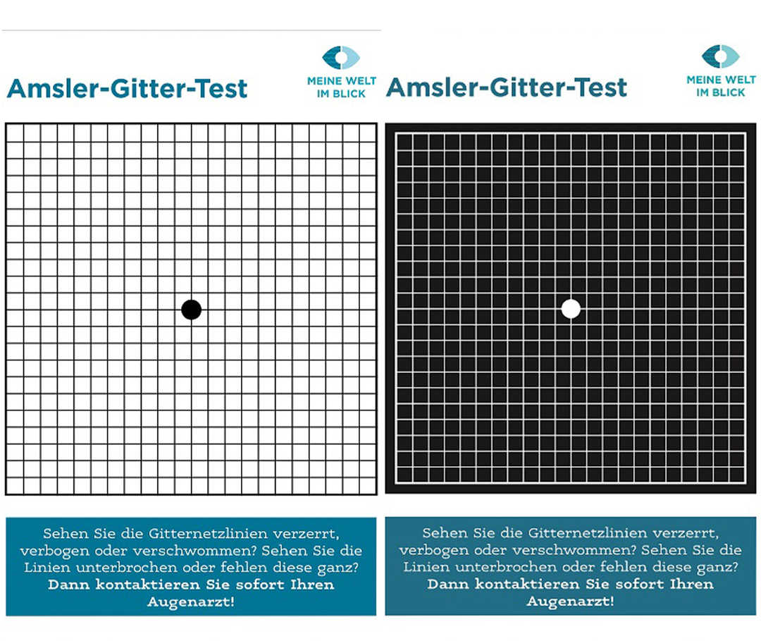 Ratgeber Makula: Teaserbild für die beiden Amlser-Gitter Teaserbild für die beiden Amlser-Gitter